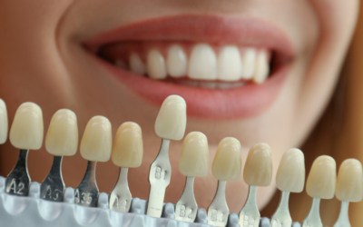 3 Essential Dental Tips for a Healthy Smile