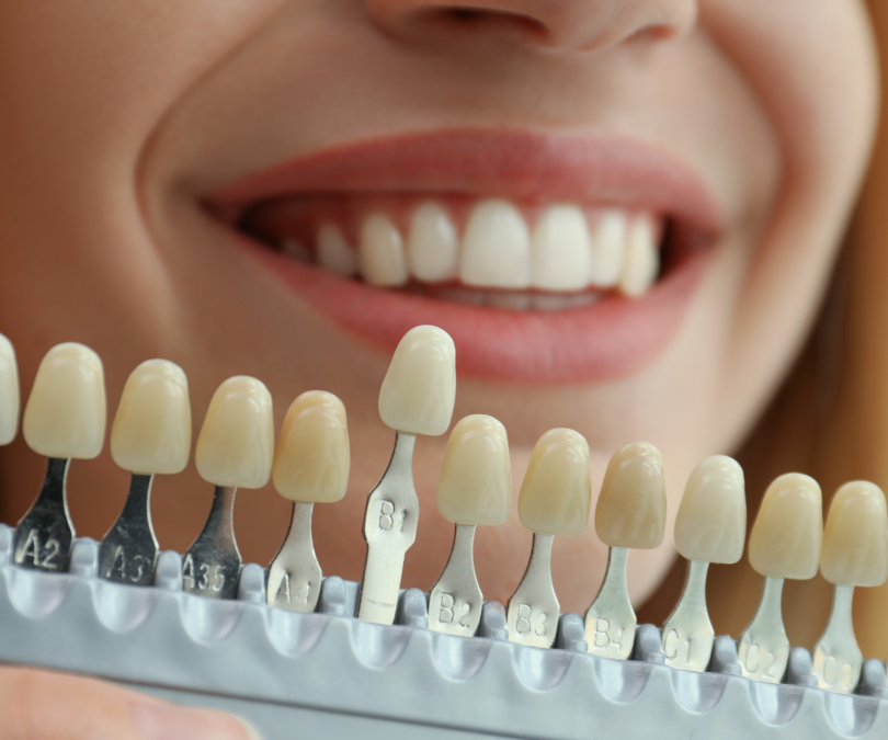 3 Essential Dental Tips for a Healthy Smile